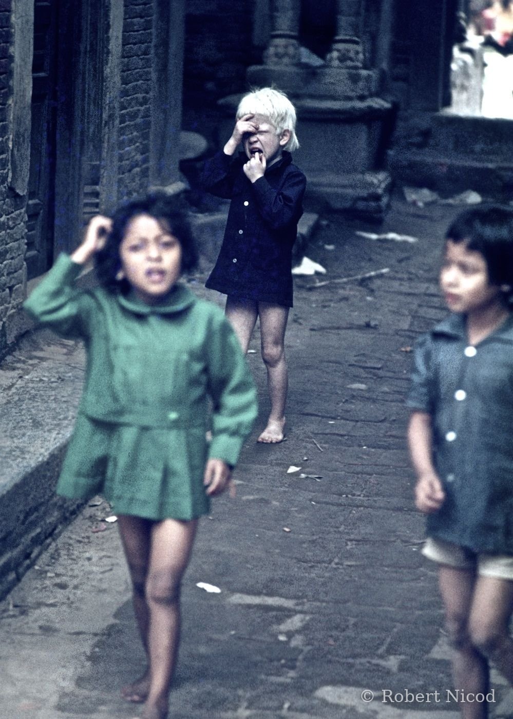 Nepal 1977 — Albino child, mocked as elsewhere in the world, Kathmandu 1977